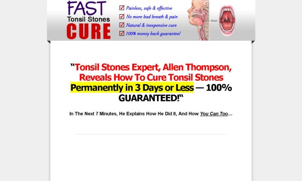 Fast Tonsil Stones Cure1
